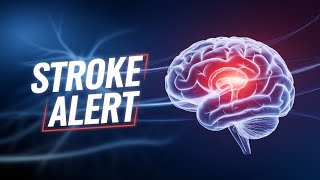 Stop Strokes Before They Start: Life-Saving Tips You Need to Know!