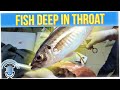 Fisherman Has Live Fish Stuck in His Throat in Bizarre Accident (ft. Big Boy)