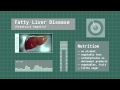 Fatty Liver Disease - Symptoms, Treatment, and Research