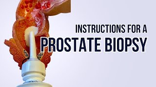 Instructions for Prostate Biopsy