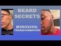 HOW I GREW A BEARD IN 3 MONTHS | CRAZY TRANSFORMATION