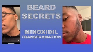 HOW I GREW A BEARD IN 3 MONTHS | CRAZY TRANSFORMATION