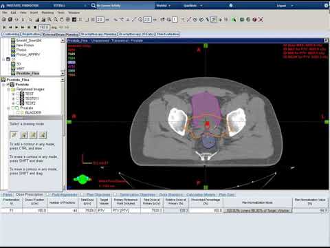 6 Optimization for Prostate IMRT   2