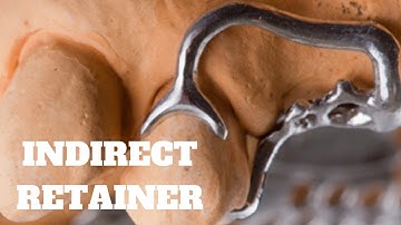 Types of Indirect Retainer in Removable Partial Denture