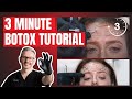 Simple botox tutorial  common botox patterns  botox units guide
