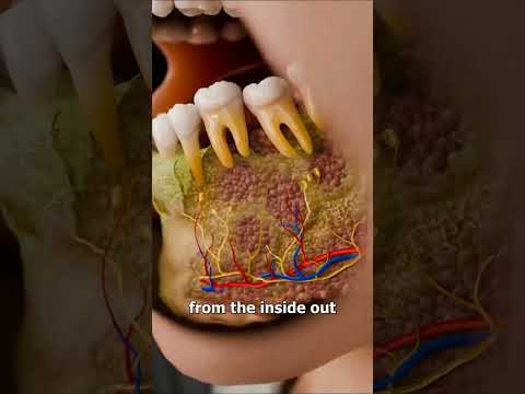 كيف أفسدت أعواد الثقاب فكي الفتيات