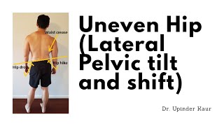 Lateral Pelvic tilt and Pelvic shift