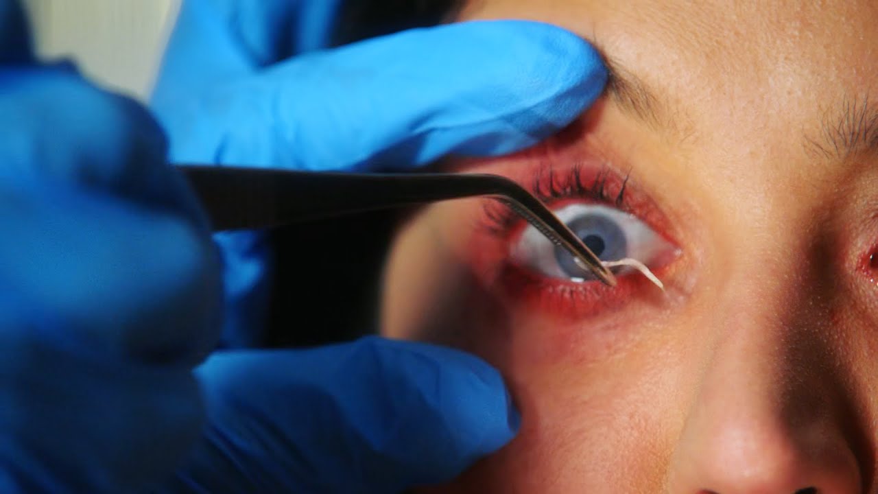 Parasites growing in her eyes just because she doing this!!! 