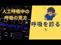 呼吸を診る①　人工呼吸中の呼吸のみかた