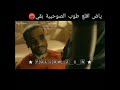 حالات واتس عبده موتة قسي و جراح 