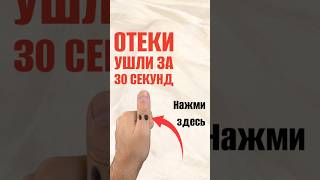 Вот почему ваши ноги отекают к вечеру! Скрытая причина - в почках.