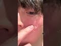 Instagramで2万回以上再生されたゼオスキン動画