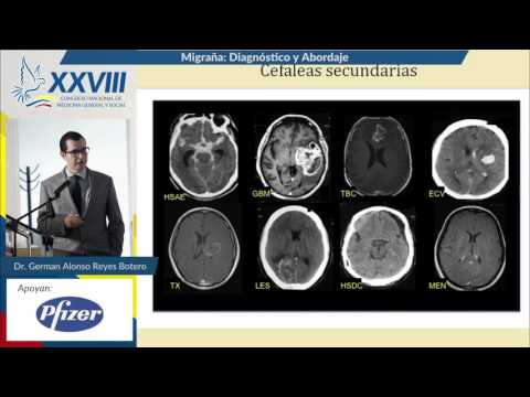 Vídeo: Optimizar El Tratamiento De La Migraña: De Las Interacciones Farmacológicas A La Medicina Personalizada