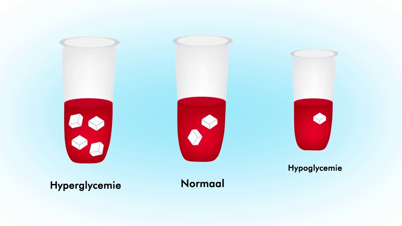 Gevolgen van diabetes mellitus (Deel 4)