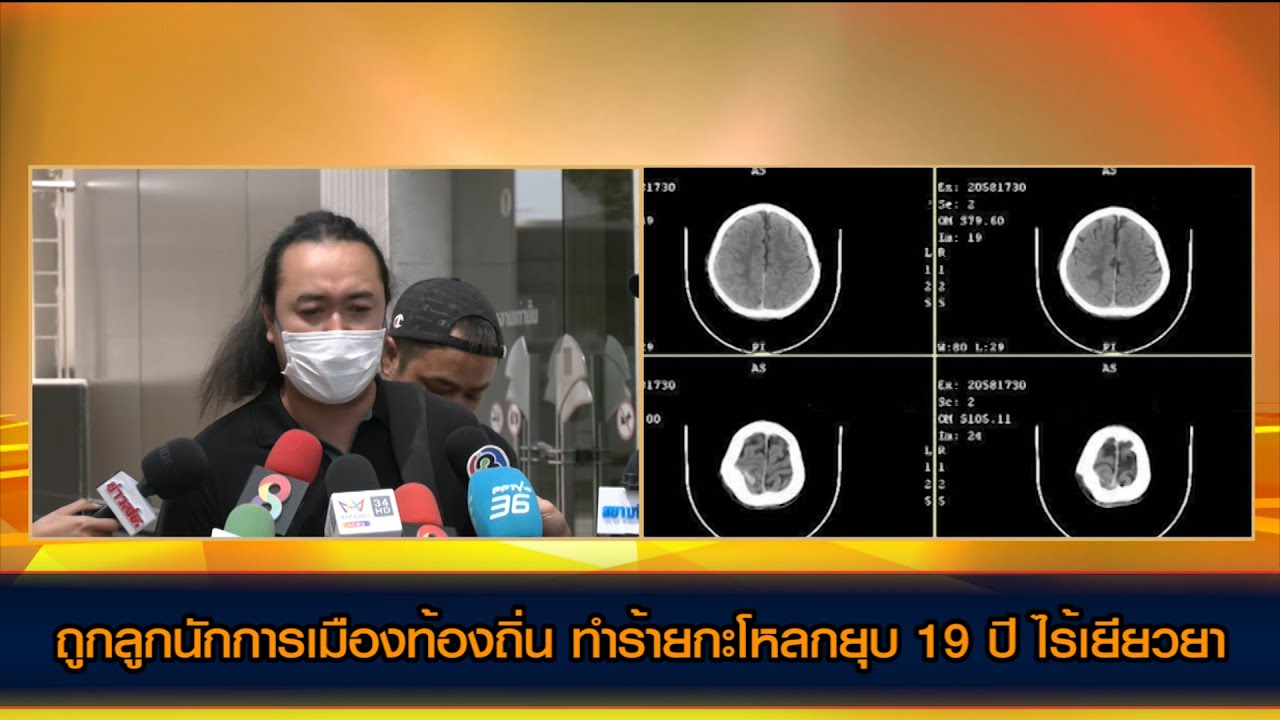 หนุ่มร้อง ถูกลูกนักการเมืองท้องถิ่น ทำร้ายกะโหลกยุบ 19 ปี ไร้เยียวยา กลัว ลุง-ป้า จะโดนเหมือนกัน