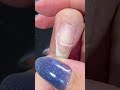 【亀裂ネキ】今回はアクリル補強の回です