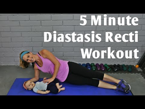 Video: Diastasis Recti Miehillä Ja Yksinäisillä Naisilla