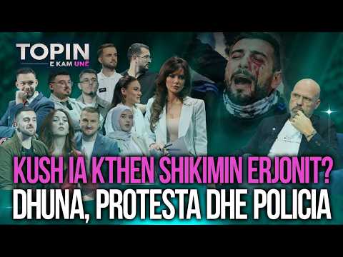 Dhuna, protesta dhe Policia! Manjani përballë të rinjve! Kush ia kthen shikimin Erjonit?