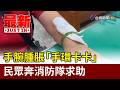手腕腫脹「手環卡卡」 民眾奔消防隊求助【最新快訊】