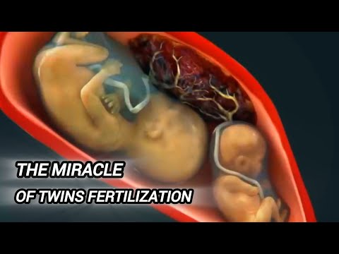The Miracle of Twins Fertilization | How Are Twins Formed Twins Birth Story