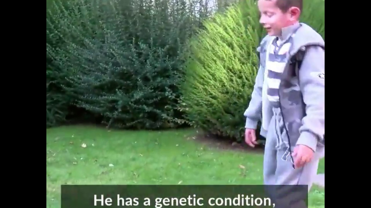 science jobs london Boy with a genetic disease has had almost all his skin replaced