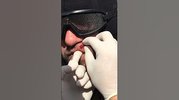 WHY FACE PROTECTION? #airsoftshorts #airsoft #airsoftvideo