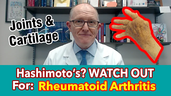 Why Hashimoto's Patients Should WATCH OUT for Rheumatoid Arthritis (painful, swollen joints)