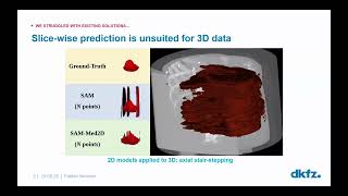 Fabian Isensee: nnInteractive: universal interactive 3D segmentation from intuitive 2D prompts