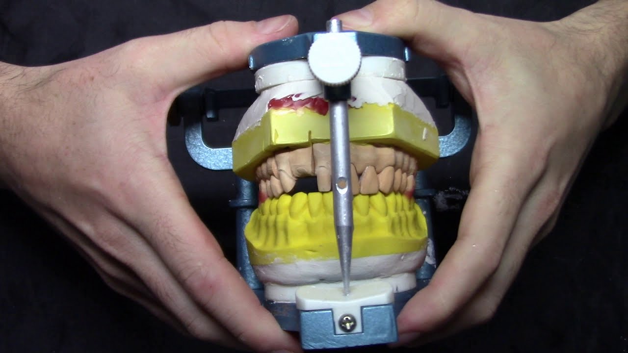 Daylı Model Artikülatöre Alma-Articulator in Die Model