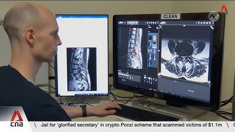 NUH uses AI to interpret MRI scans quicker, generate explanatory videos