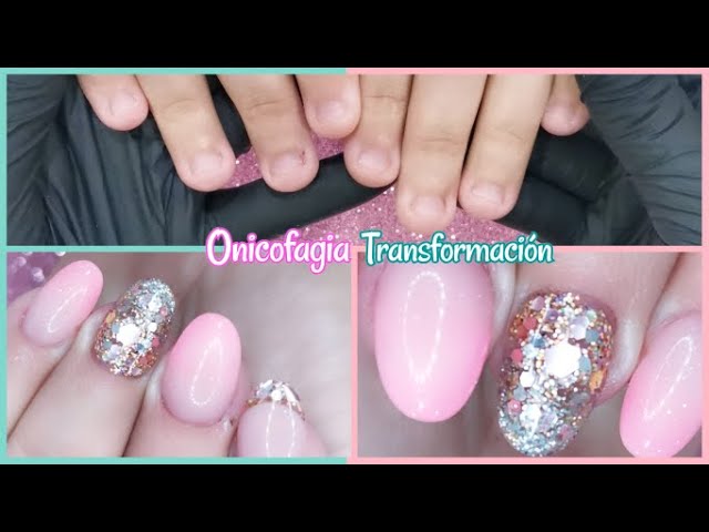 COMO TRANSFORMAR UÑAS MORDIDAS CON ACRILICO / ONICOFAGIA / UÑAS ACRILICAS  ESCULTURALES - thptnganamst.edu.vn