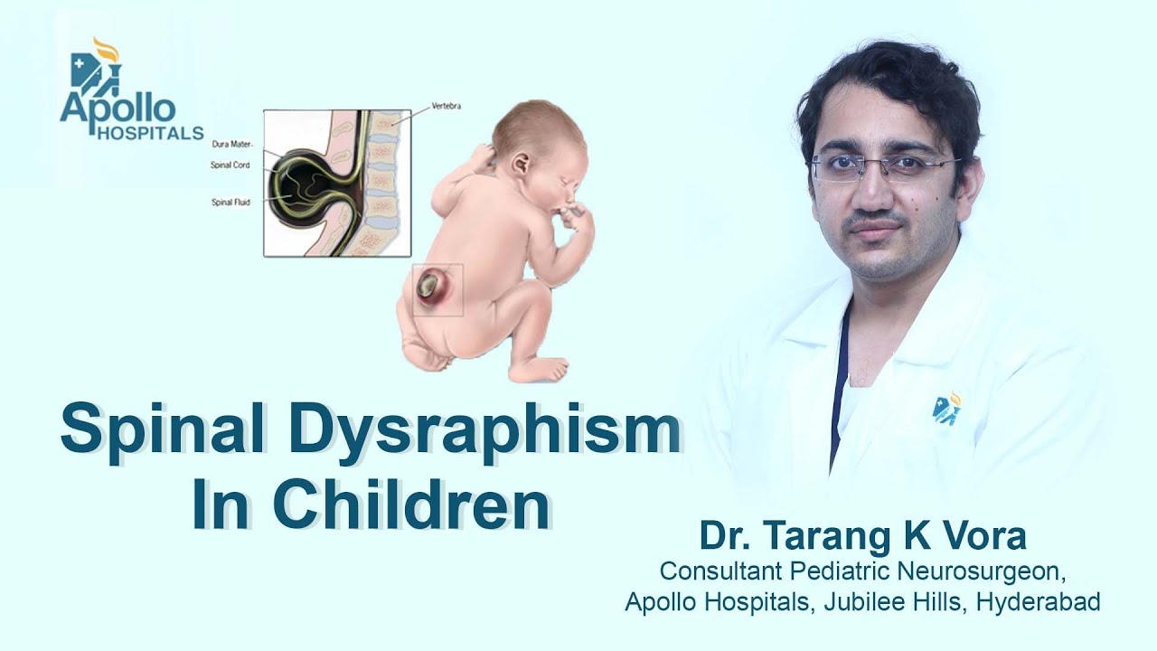 Spinal Dysraphism In Children | Dr. Tarang Vora, Pediatric Neurosurgeon | Apollo Hospitals Hyderabad