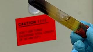 Preparing a serum specimen using a serum separator tube