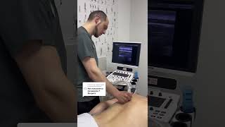 Результаты инъекции в спину в MIOFIX  при Фиброзе Мышц