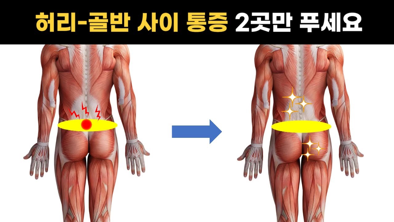 [허리 통증 마사지] 딱 2곳만 풀어보세요, 허리가 달라집니다