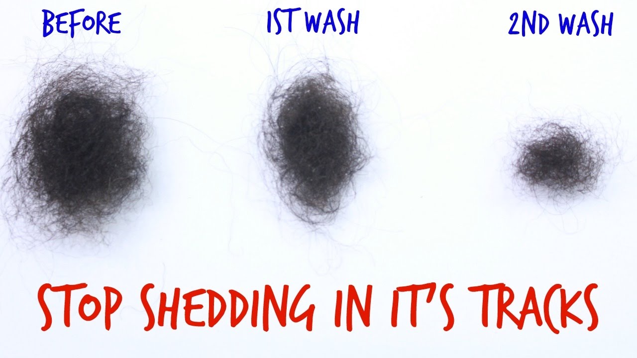 Instantly Stop Hair Shedding Breakage YouTube