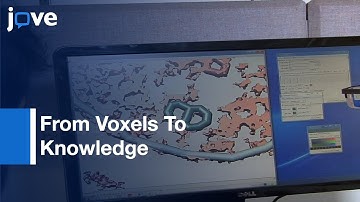 Practical Guide To Segmentation Of Complex Electron Microscopy 3D-Data l Protocol Preview