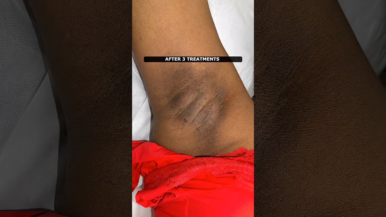 All skin types. One smooth solution. 🖤🤎