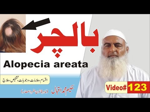 Alopecia Areata Balchir ► #123 ► بالچر گنج پن ► एलोपेशिया एरियाटा ► Nukta Guidance