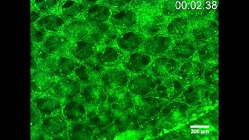 Suppl  video 5 Fluo 8 Ca Imaging 3D day 50 100 frames