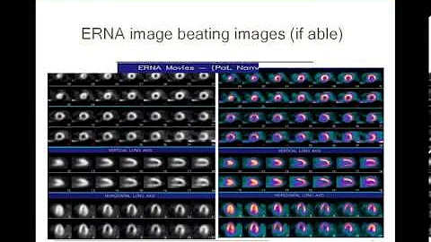 Case Studies: Documenting Your Facility's Quality - IAC Nuclear webcast