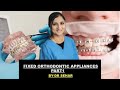 Fixed Orthodontic Appliances Part 1 | INBDE, ADAT, AFK Prep Course | Dr. Sehar’s Online Lessons