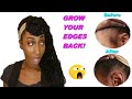 5 Tips to Grow Your Edges Back| Natural Hair Tutorial | Episode 7