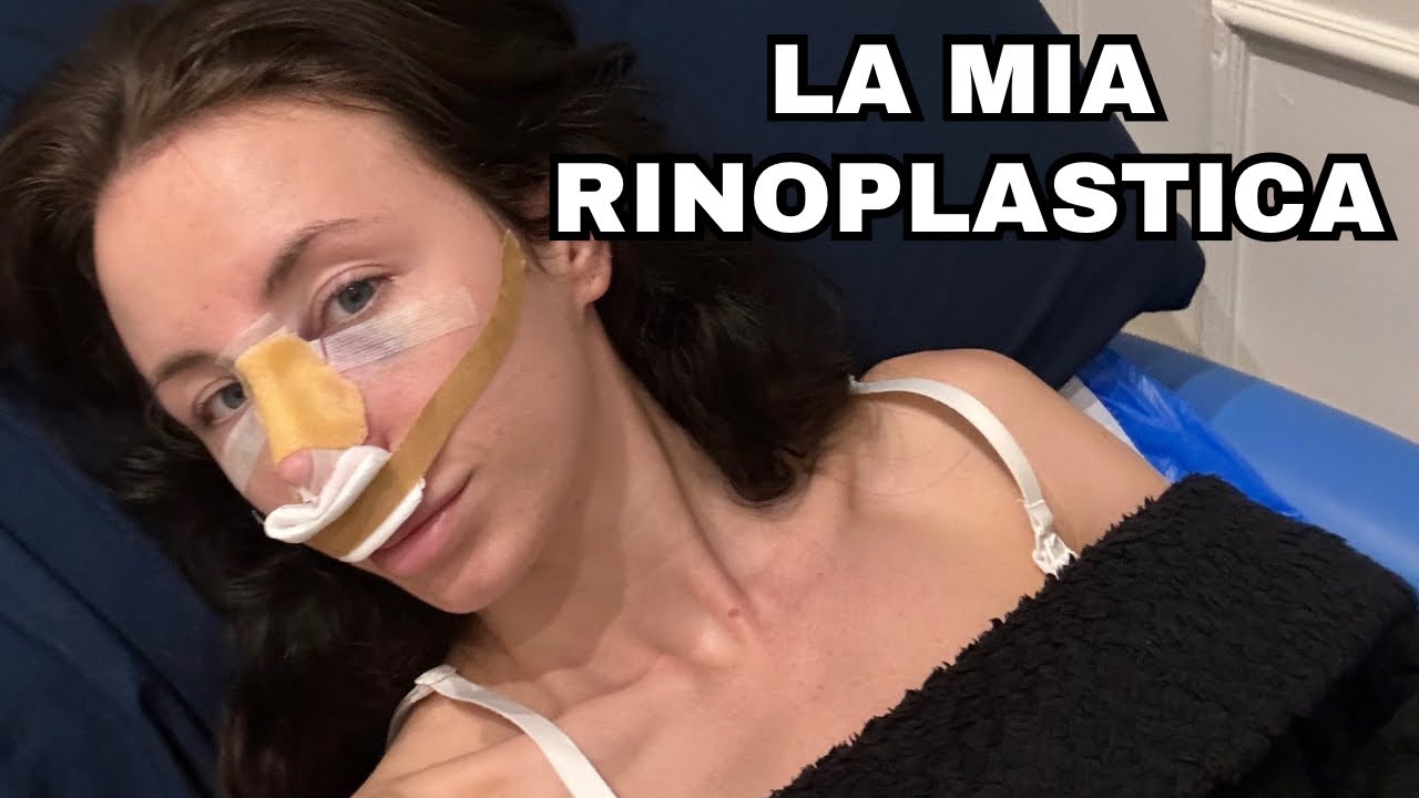 RINOPLASTICA: OPERAZIONE E CONVALESCENZA | Vi racconto la mia esperienza / Natalia Liberati