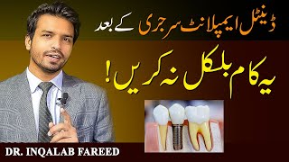 Dental Implant After Care | Post Surgery Instructions | Urdu | Hindi | @InqalabFareed