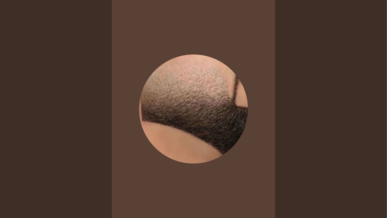 Ingrown hairs zone .6 is live\#ingrownhair #oddlysatisfying #oddlysatisfyingvideo #satisfying
