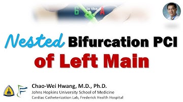 Nested Bifurcation Stenting of Left Main Trifurcation