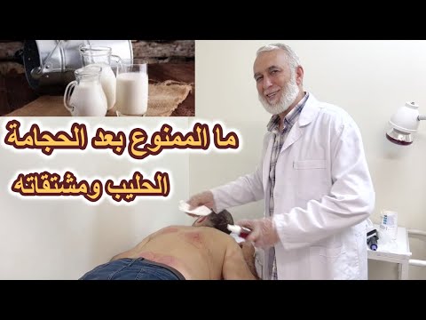 ما الممنوع بعد الحجامة