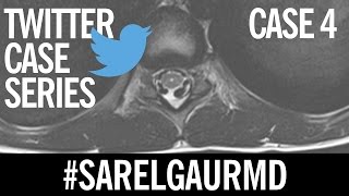 Twitter Interactive Case Series:  Case 4