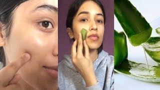 I USED ALOE VERA GEL ON MY FACE FOR 3 WEEKS AND THIS IS WHAT IT DID TO MY SKIN